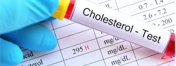 Understanding Serum Cholesterol: What It Is and Why It Matters for Your Health